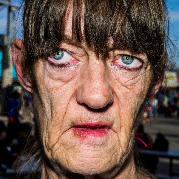 Признаки того, что вы уже переболели коронавирусом